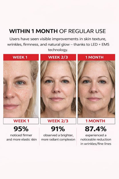 LumiFace™ – Radiance LED Facial Massager